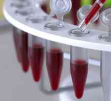 Имуноензимен анализ на кръвта: тълкуване на резултата