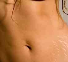 Информация за жените: как да премахнете стрии на стомаха