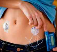 Инсулинова помпа - инсталация, видове, приложение