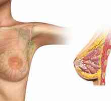 Инвазивен рак на гърдата: причини, диагноза, лечение. Кръв на събеседници