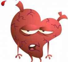 Исхемична болест на сърцето. Какво е това и какви са неговите проявления?