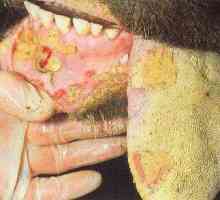 Болест на шап при животни: характеристики на развитието на болестта и методи за нейното лечение