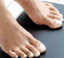 Епидермофития на краката: причини, симптоми и лечение