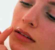 Как да се отървете от настинки на устните: списък на най-ефективните методи