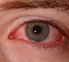 Как да се отървете от синдрома на сухото око?