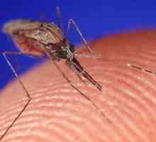 Как да се отървете от сърбеж от ухапвания от комари? Полезни съвети