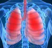 Как се лекува пневмония? Полезни препоръки