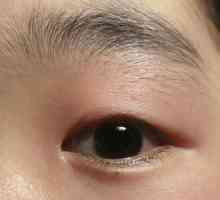 Как да се третира ечемика на очите на децата? Причини за появата