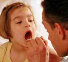 Как да третираме тонзилит при деца