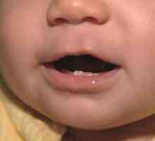 Как да различаваме бебешкия зъб от корените на бебето?