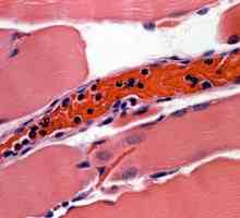 Как да намалим левкоцитите в кръвта? Причините за повишени бели кръвни клетки. Съвети за лекарите…