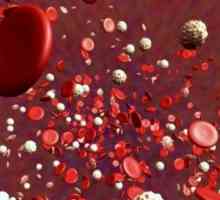 Как да увеличите броя на тромбоцитите в кръвта у дома