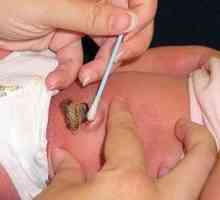 Как пъпа се третира правилно при новородено