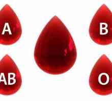 Как да решим проблема за кръвната група и Rh фактора