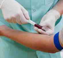 Как да преминем кръвен тест за стерилитет?