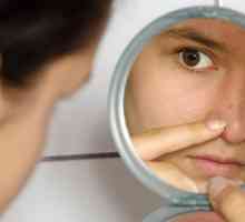 Как да премахнете черни точки на носа на тийнейджър?