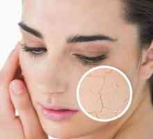Как да премахнете мащабиране на лицето? Съвети за грижа за кожата