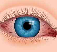 Капки за очите вазоконстриктивни: приложение и наименования на препарати