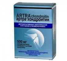 Капсули "Artra Chondroitin": инструкции за употреба, аналози
