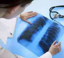 Кашлица с туберкулоза: признаци и симптоми