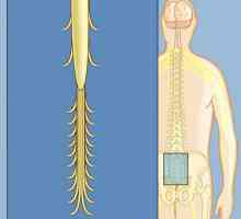 Синдром на "конска опашка": описание, причини, симптоми и лечение