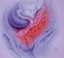Регионална плацента превия - заплаха за нормалния ход на бременността