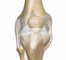 Кръстно съединение на колянната става: травма, лечение, рехабилитация
