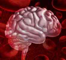 Хеморагии в мозъка: симптоми, лечение, последствия, прогноза