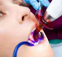 Полимеризация стоматологична лампа: защо е необходимо и как да го изберете?