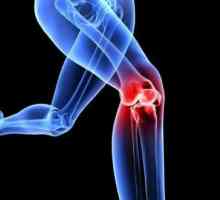 Физиотерапия упражнения за артроза на колянната става: упражнения, правила за тяхното изпълнение