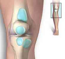 Лечение на бурсит на колянната става: връщаме лекота на ходене
