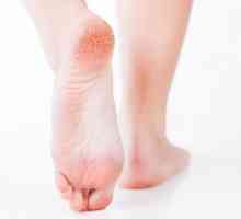 Лечение на гъбички от крака с ефективни лекарства и народни методи