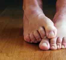 Лечение на гъбички на ноктите на краката с народни средства