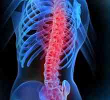 LFK за гръбначния стълб: упражнения и процедури
