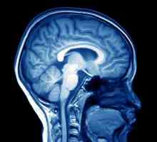 Likvorodinamichesky мозъчни нарушения: признаци, лечение