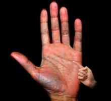 Линията на слънцето върху ръката в дланта: значението и тълкуването