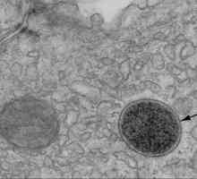 Лизозом: структура и функция на клетъчните органи
