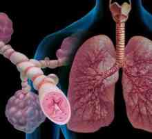 Medicine. Медицински грижи за бронхиална астма