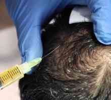Мезотерапия за коса: прегледи, плюсове и минус процедури
