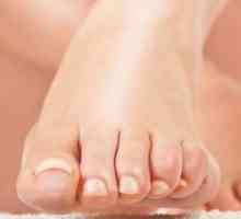 Микоза на ноктите на краката: лечение с лекарства и народни средства