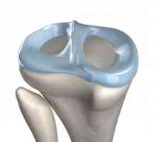 Калъфче за коляно: вид наранявания, лечение