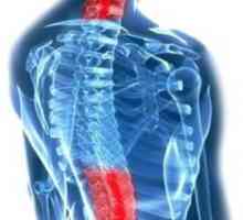 MKB: остеохондроза на гръбнака. Код на болестта и описание