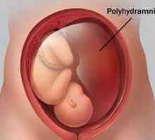 Полихидрамнион по време на бременност: причини и последици. Ефект на полихидрамините върху раждането