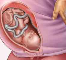 Полихидрамниои по време на бременност: причини, лечение, възможни последици за детето