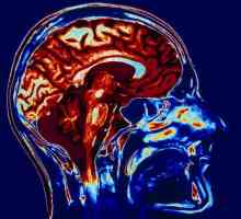 MRI на мозъка: как е процедурата? Как да се подготвим за MRI на мозъка?