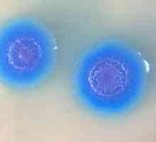 Mycoplasma genitalium: какво е това? Колко опасна е инфекцията?