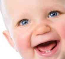 Какви родители трябва да обърнат внимание, когато бебе има зъбобол