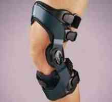 Подложки за коляното с артроза. Видове. Характеристики на употреба