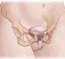 Инконтиненция на урината при кашлица: причини и методи на лечение