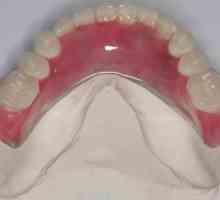 Найлонова протеза с пълна липса на зъби и частична. Отзиви за найлон протези